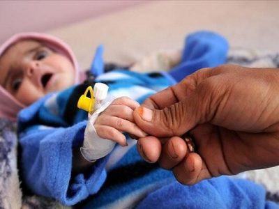 در هر ساعت؛ ۶ کودک یمنی بخاطر نتایج جنگ جان خود را از دست می دهد – خبرگزاری مهر | اخبار ایران و جهان