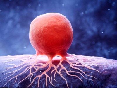 نخستین داروی جهان برای نابودی سرطان ساخته شد